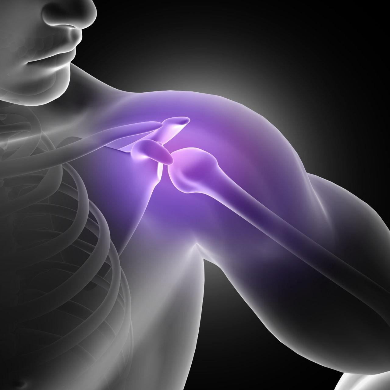 어깨 관절 클리닉 이미지