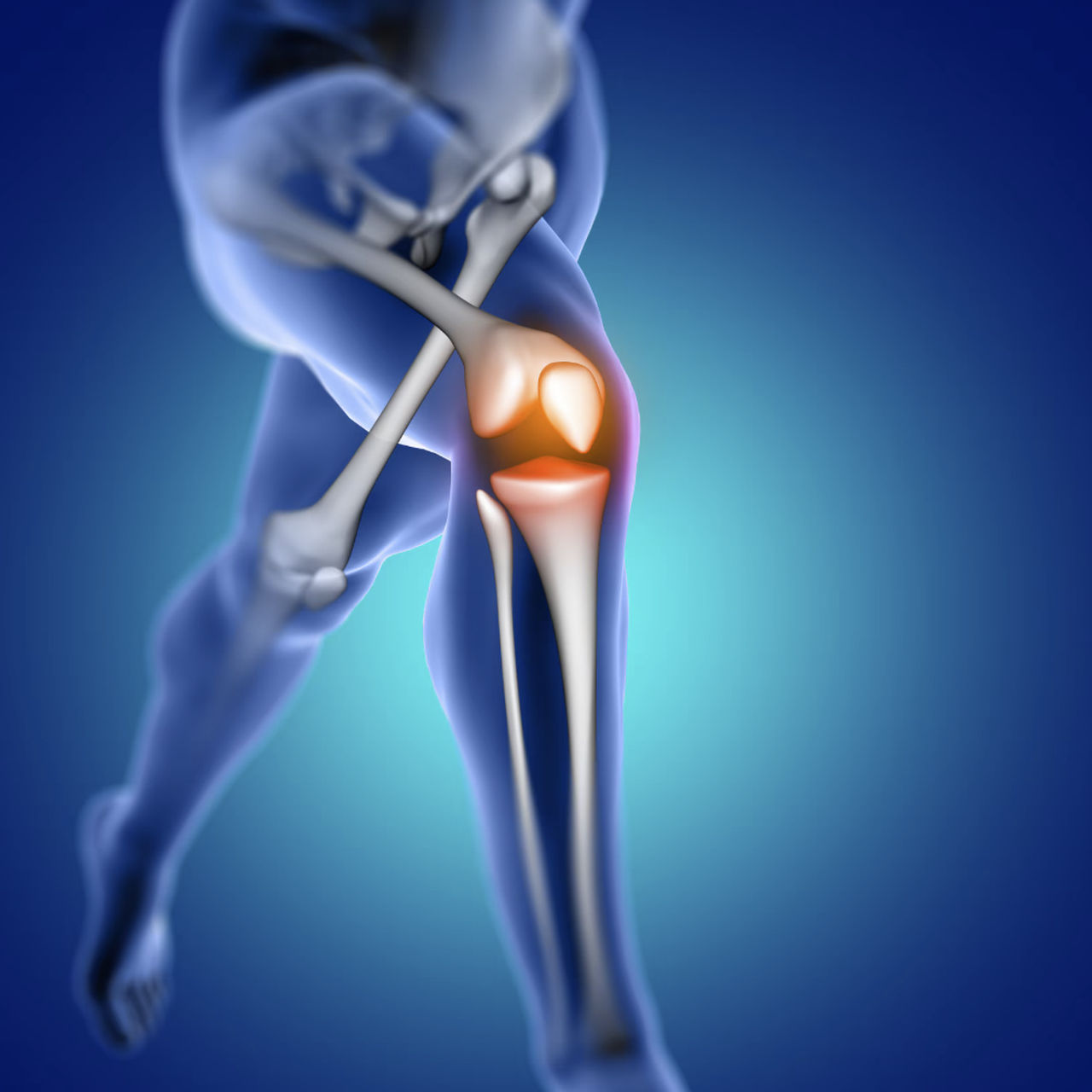 무릎 관절 클리닉 이미지